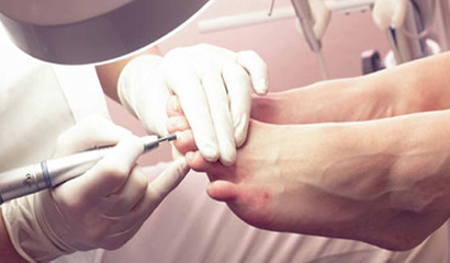 Medicinski pedikir